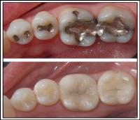 New Image General & Cosmetic Dentistry image 3